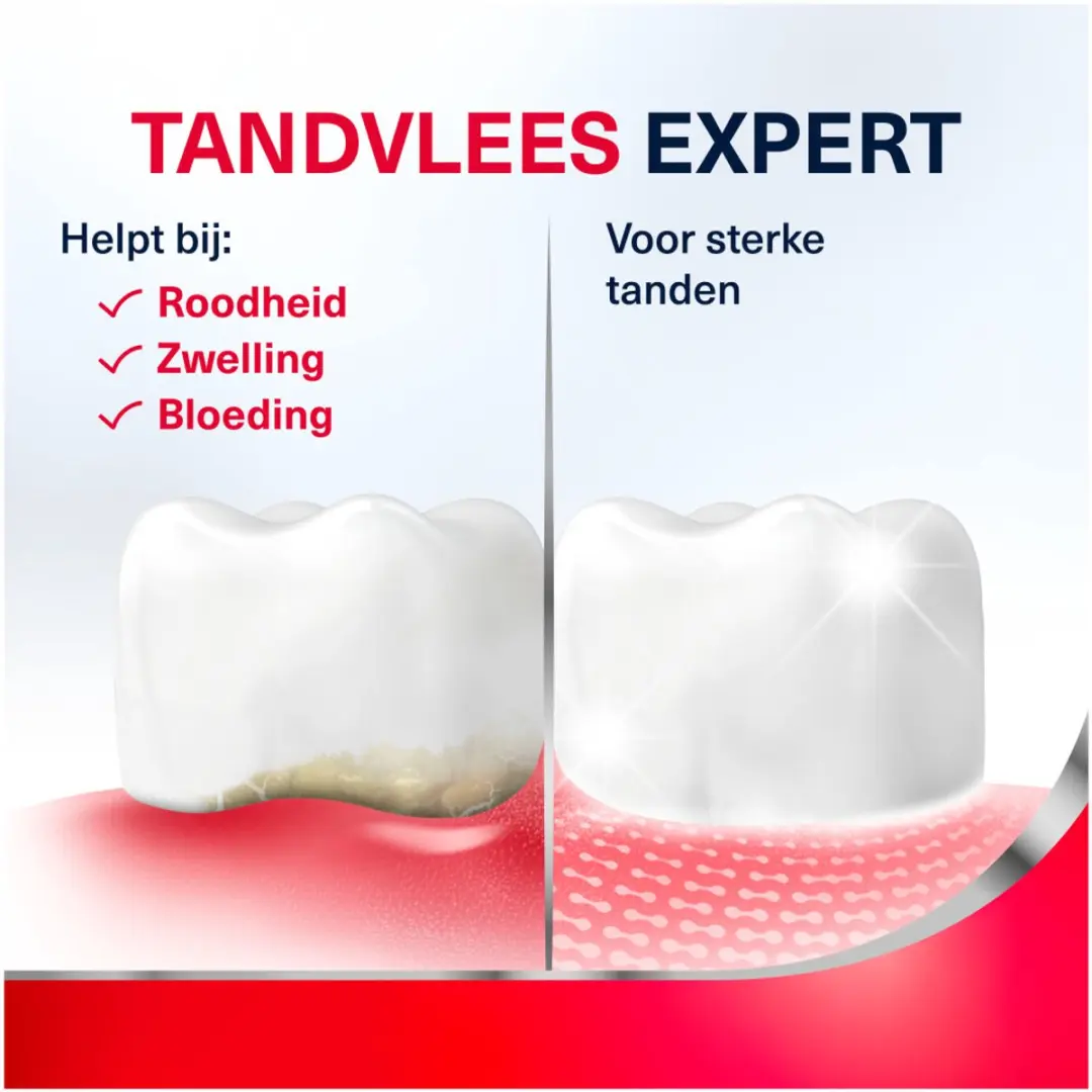 Parodontax Tandpasta Extra Fresh 75ml - Bloedend tandvlees
