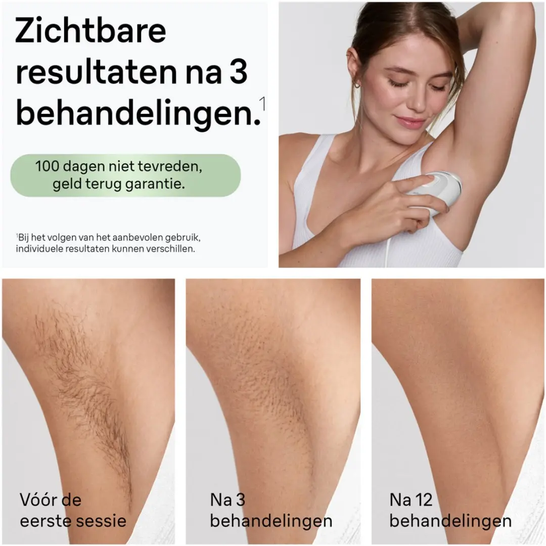 Braun Silk·expert Mini PL1115 IPL Ontharingsapparaat - 300.000 Flitsen - Wit