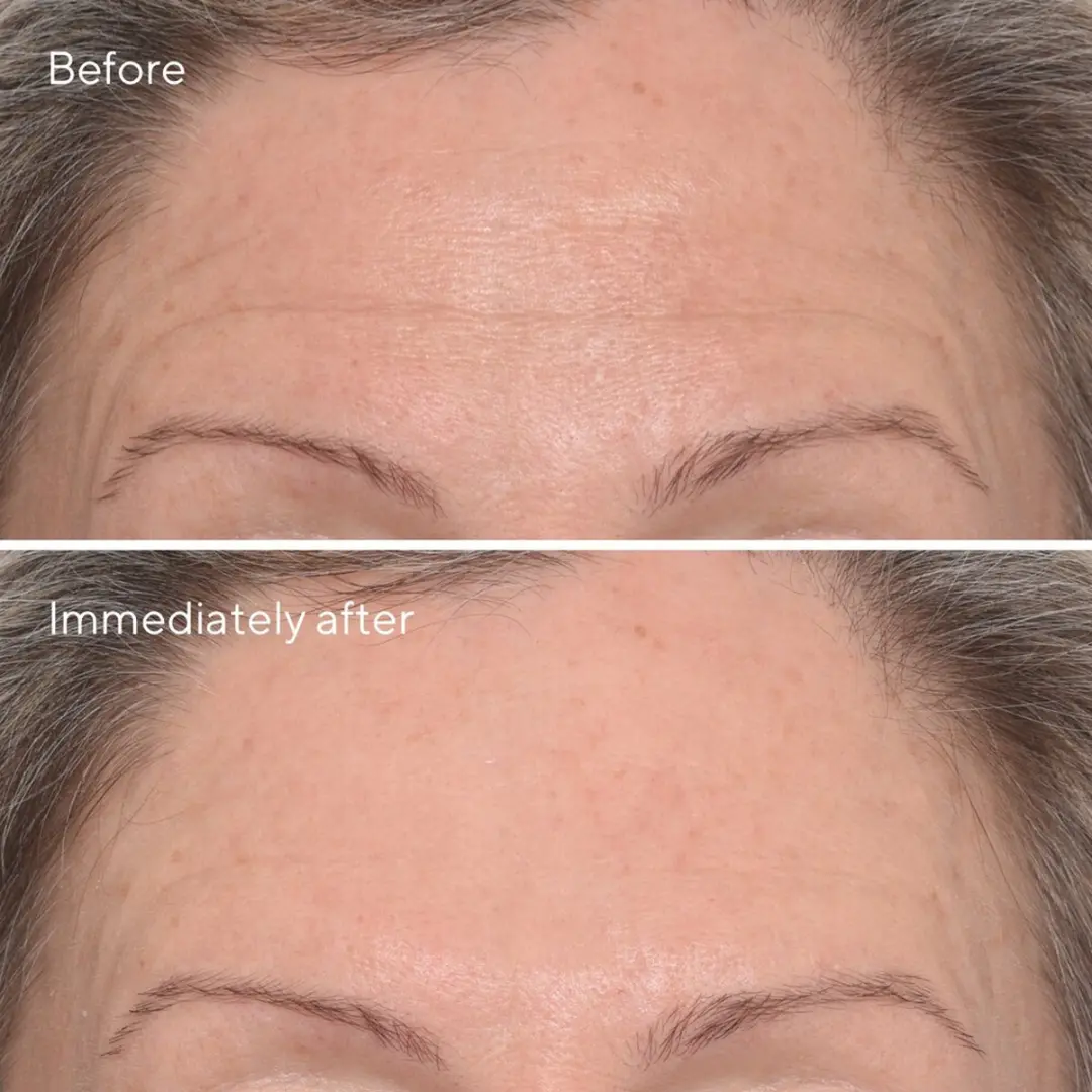 Murad Resurgence Targeted Wrinkle Corrector 1g - afbeelding 6 van 6
