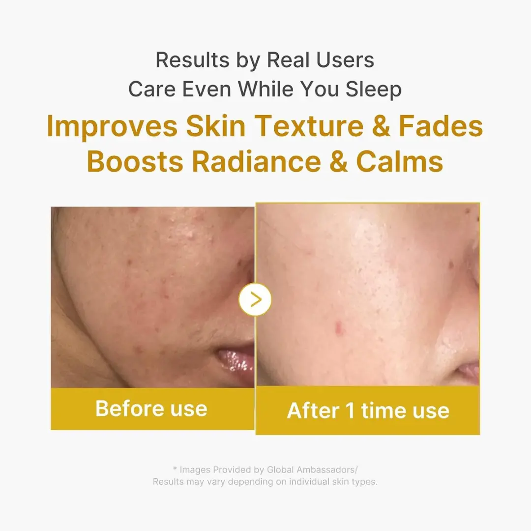 Medicube Kojic Acid Turmeric Nachtmasker 75ml