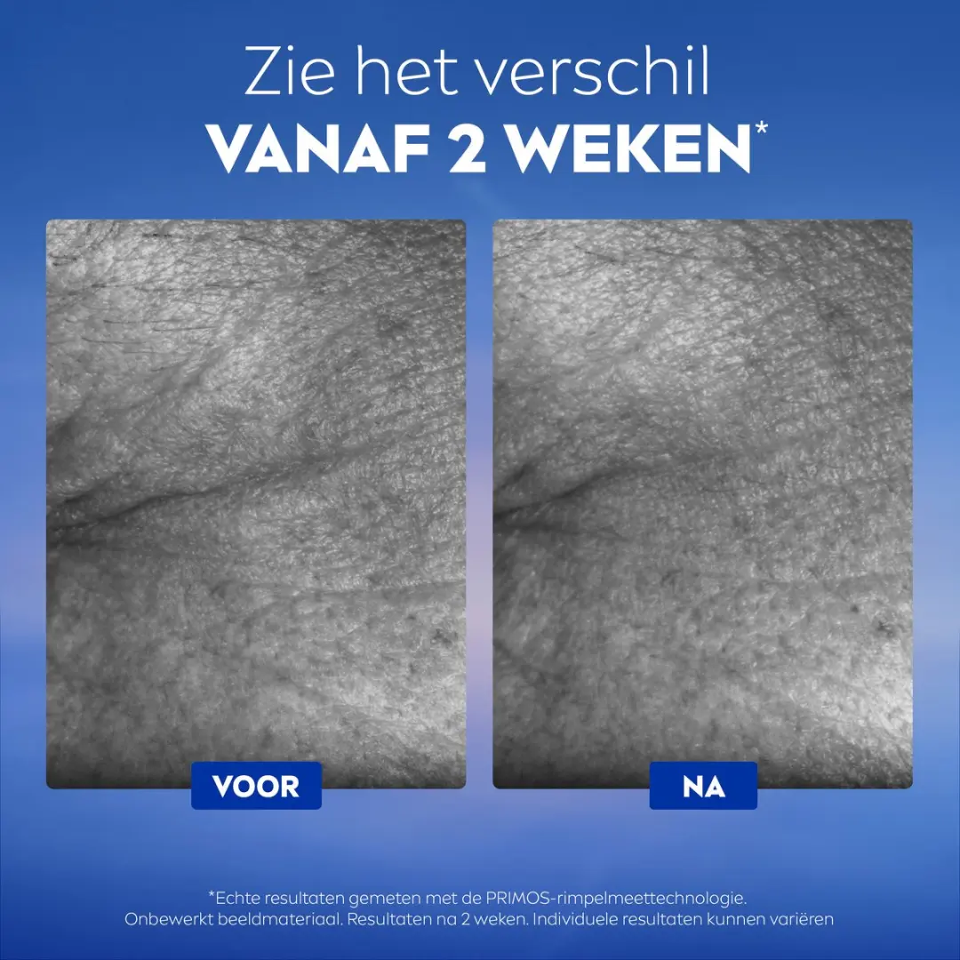 NIVEA Cellular Epigenetics Cryo Oogserum 15ml - afbeelding 4 van 6