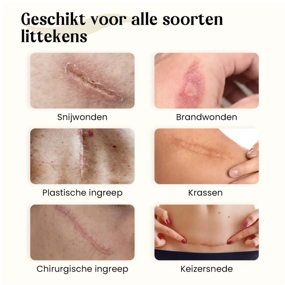 Dermatix Siliconengel Bodygel 15g - afbeelding 2 van 6