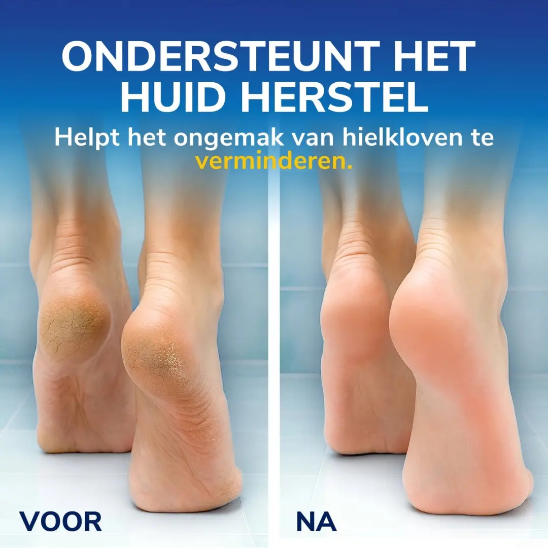 Dr. Scholl's Hielkloven Voetencrème 25% Ureum - 60ml