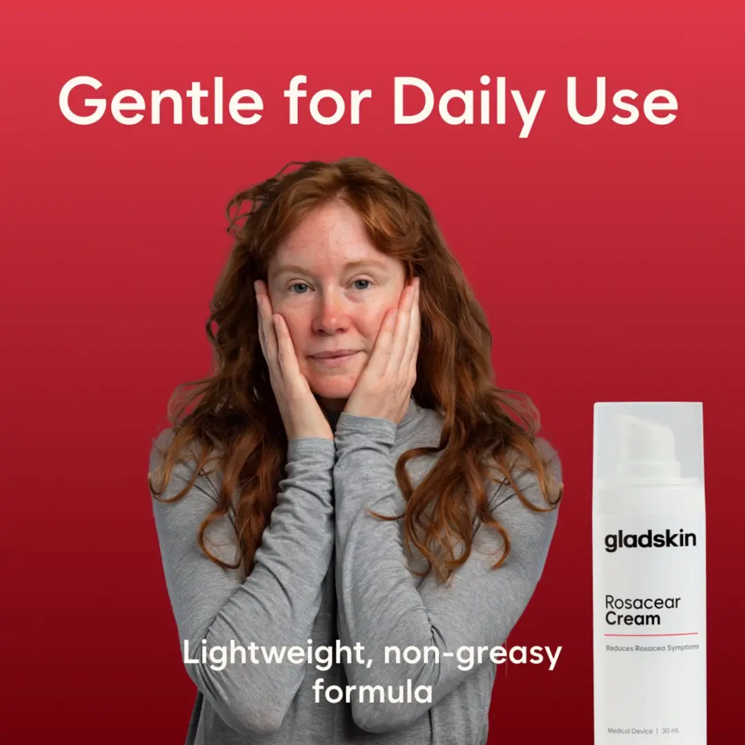 Gladskin ROSACEAR Crème 30ml - Hydraterend & Dermatologisch Getest