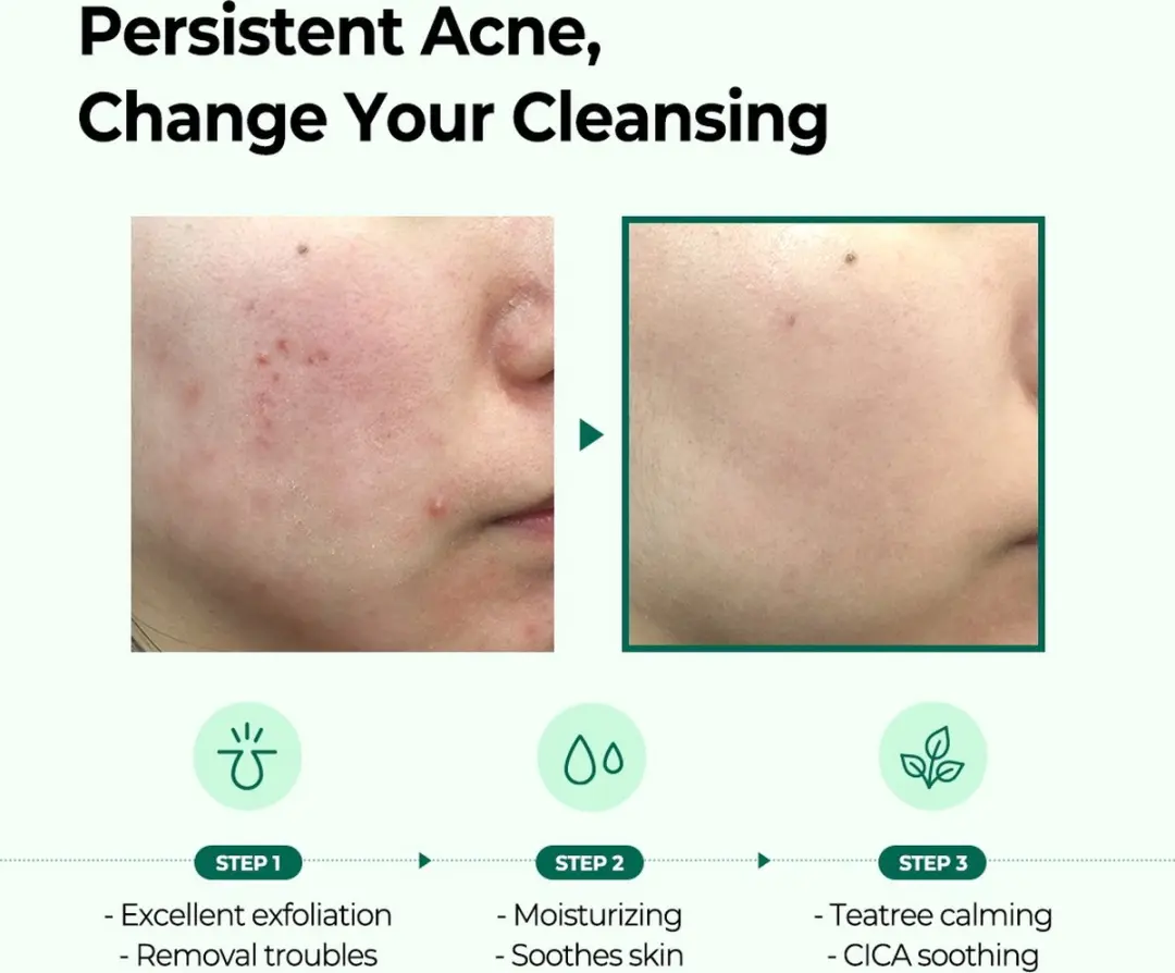 SOME BY MI AHA BHA PHA 30 Days Miracle Cleansing Bar 106g