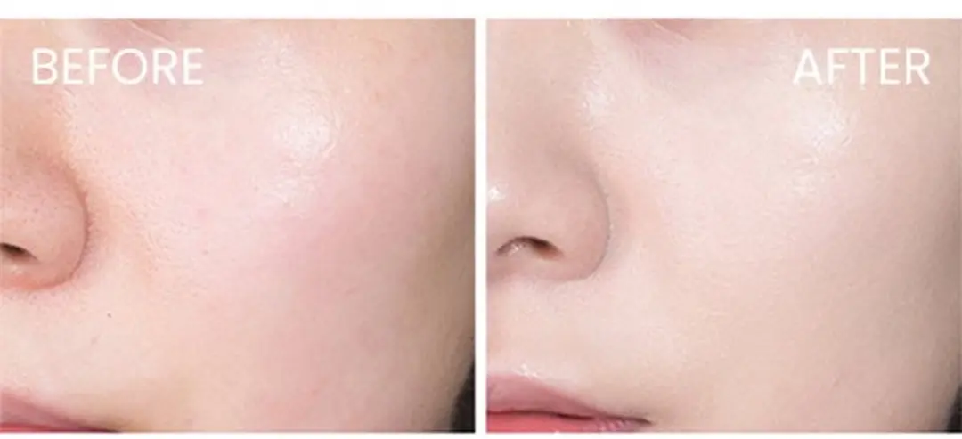 Iraltone DS Face Gel - 50ml