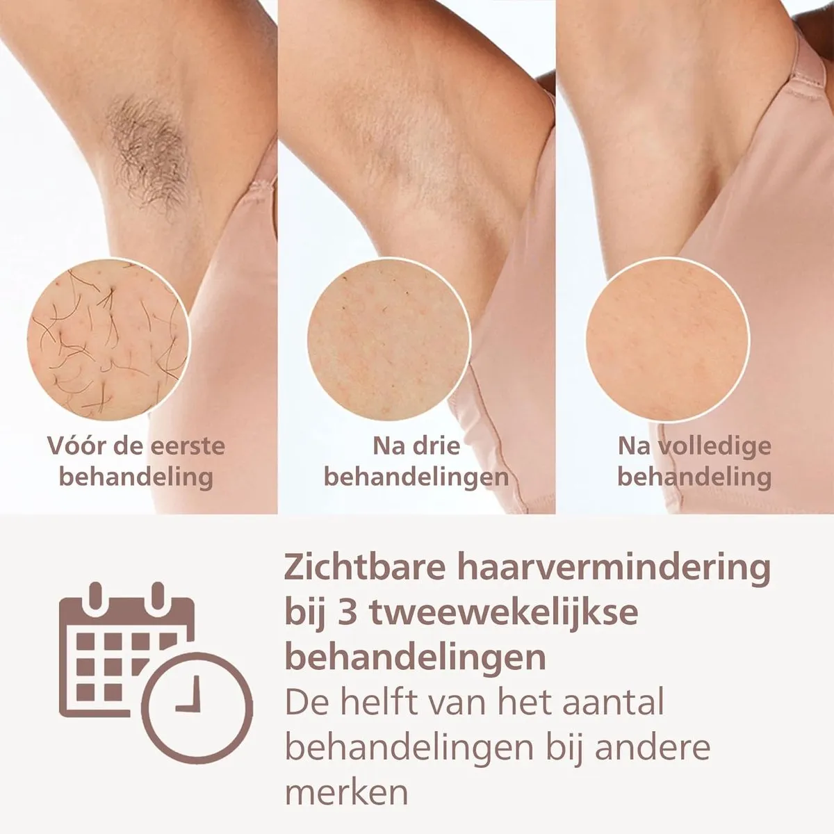 Philips Lumea IPL 9900 Series Ontharingsapparaat - 450.000 Flitsen - Roze/Roségoud