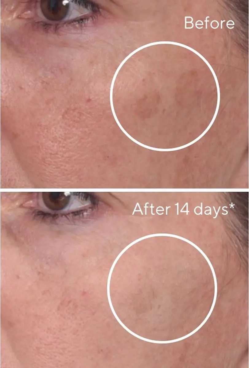 Murad Rapid Dark Spot Correcting Serum 30ml - afbeelding 3 van 6