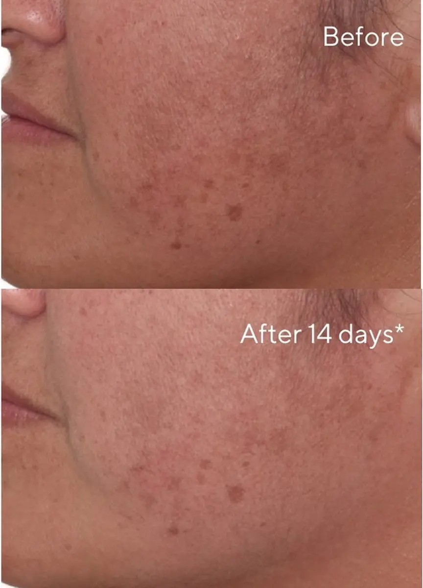 Murad Rapid Dark Spot Correcting Serum 30ml - afbeelding 4 van 6