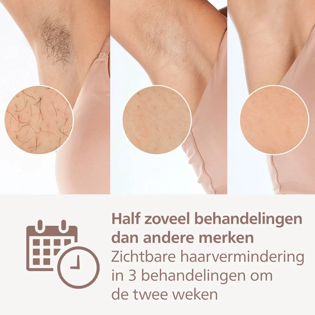 Philips Lumea IPL 9900 Series BRP959/00 Ontharingsapparaat - 450.000 Flitsen - AI Analyse - afbeelding 6 van 6