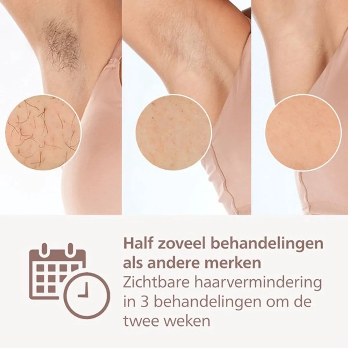 Philips Lumea IPL 9900 BRI950/02 Ontharingsapparaat - 450.000 flitsen - Roze/Wit