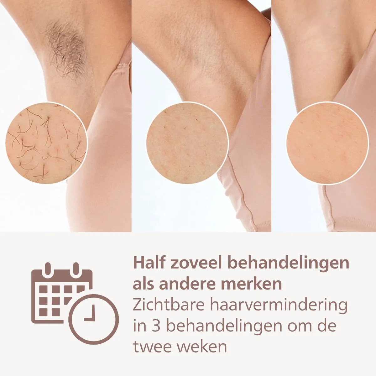 Philips Lumea IPL 9900 BRI953/02 Ontharingsapparaat - Roze/Roségoud