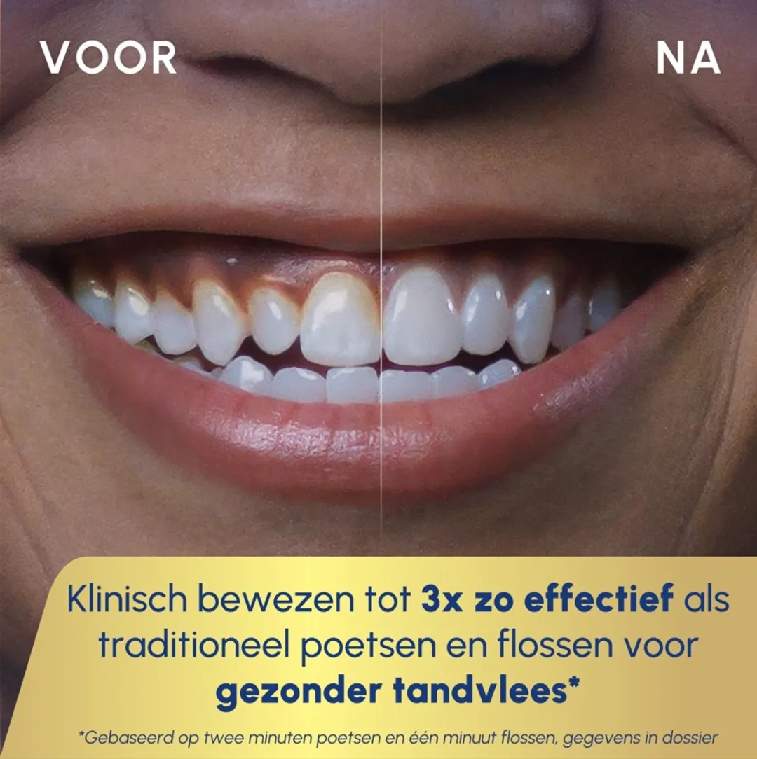 Waterpik Sensonic CC-04 Waterflosser & Tandenborstel - 3 Snelheden - Wit