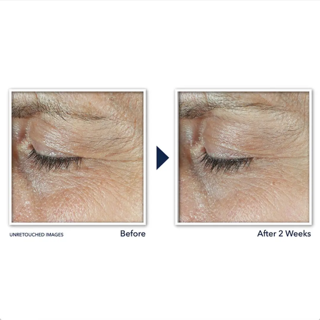 RoC Derm Correxion Dual Eye Cream - 20ml - afbeelding 5 van 6