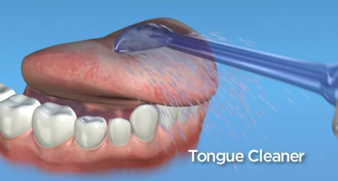 Waterpik TC-70 Tongreinigingstips - 2 Stuks