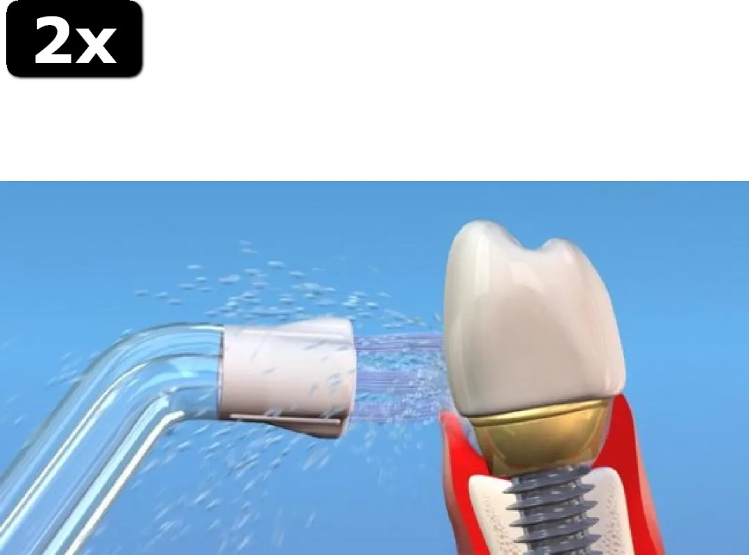 Waterpik PS-100E Plaque Seeker Tips