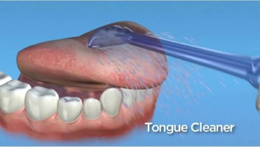 Waterpik TC-100 Tongreinigingstips - 2 Stuks - afbeelding 6 van 6