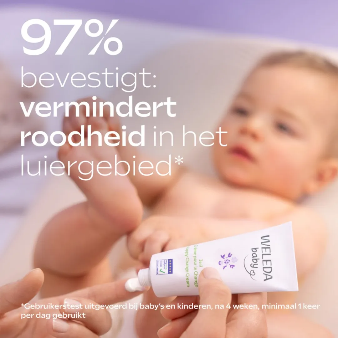 Weleda Baby Derma 3-in-1 Billenbalsem 50ml