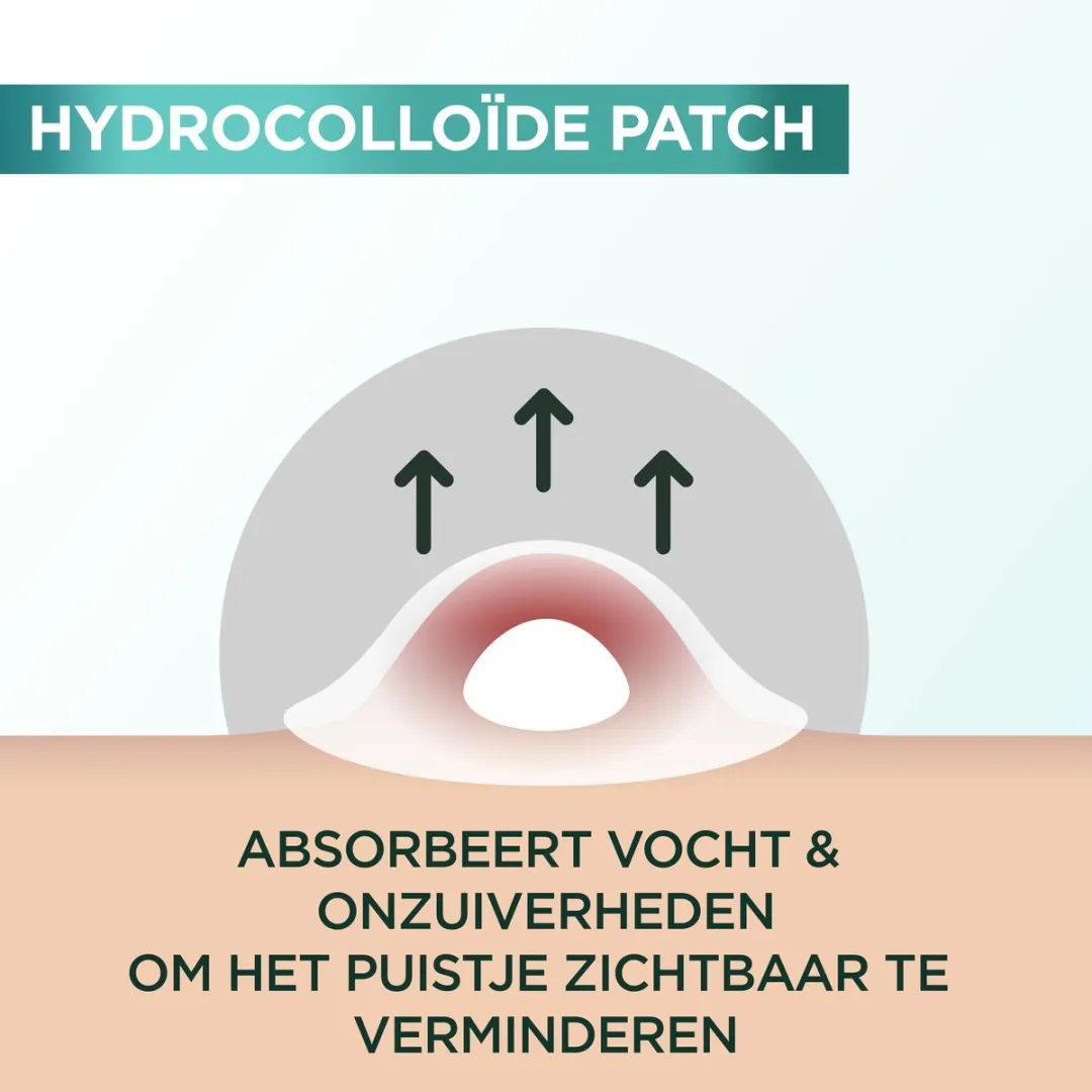 Garnier PureActive Pimple Patch - 22 Stuks
