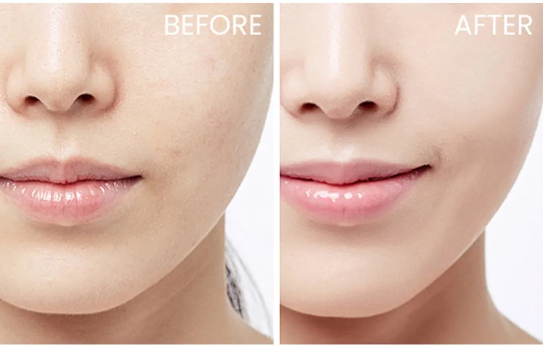 CeraVe Hydraterende melk - voor de droge tot zeer droge huid - met 3 essentiële ceramiden en hyaluronzuur - 473ml