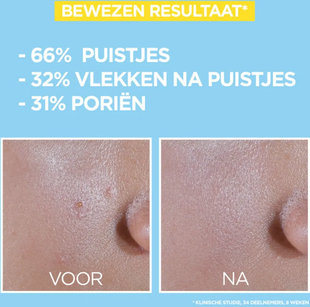Garnier PureActive BHA Niacinamide Daily Fluid SPF 50+ 40ml - afbeelding 6 van 6