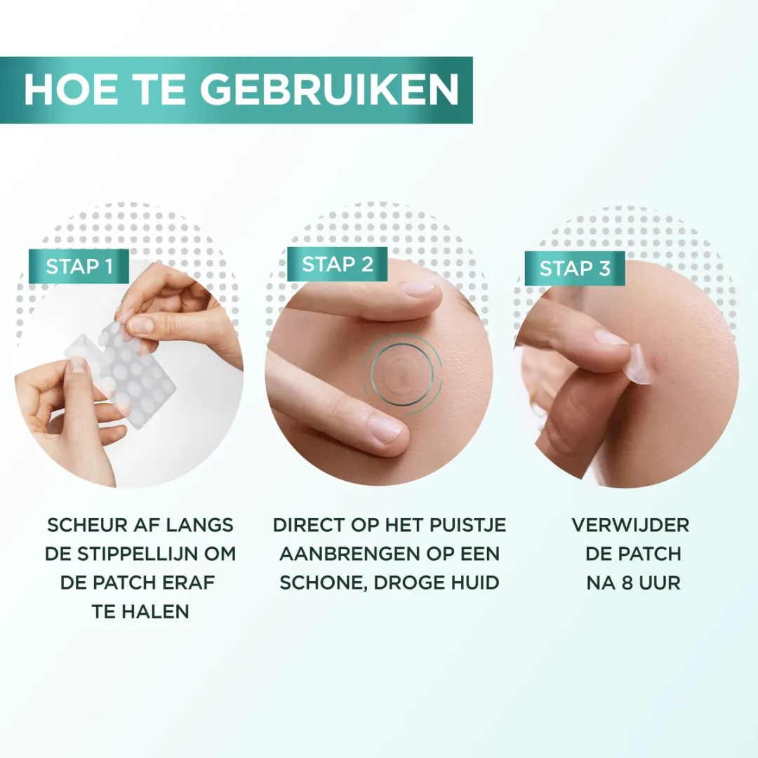 Garnier Pure Active Pimple Patch - 44 Stuks