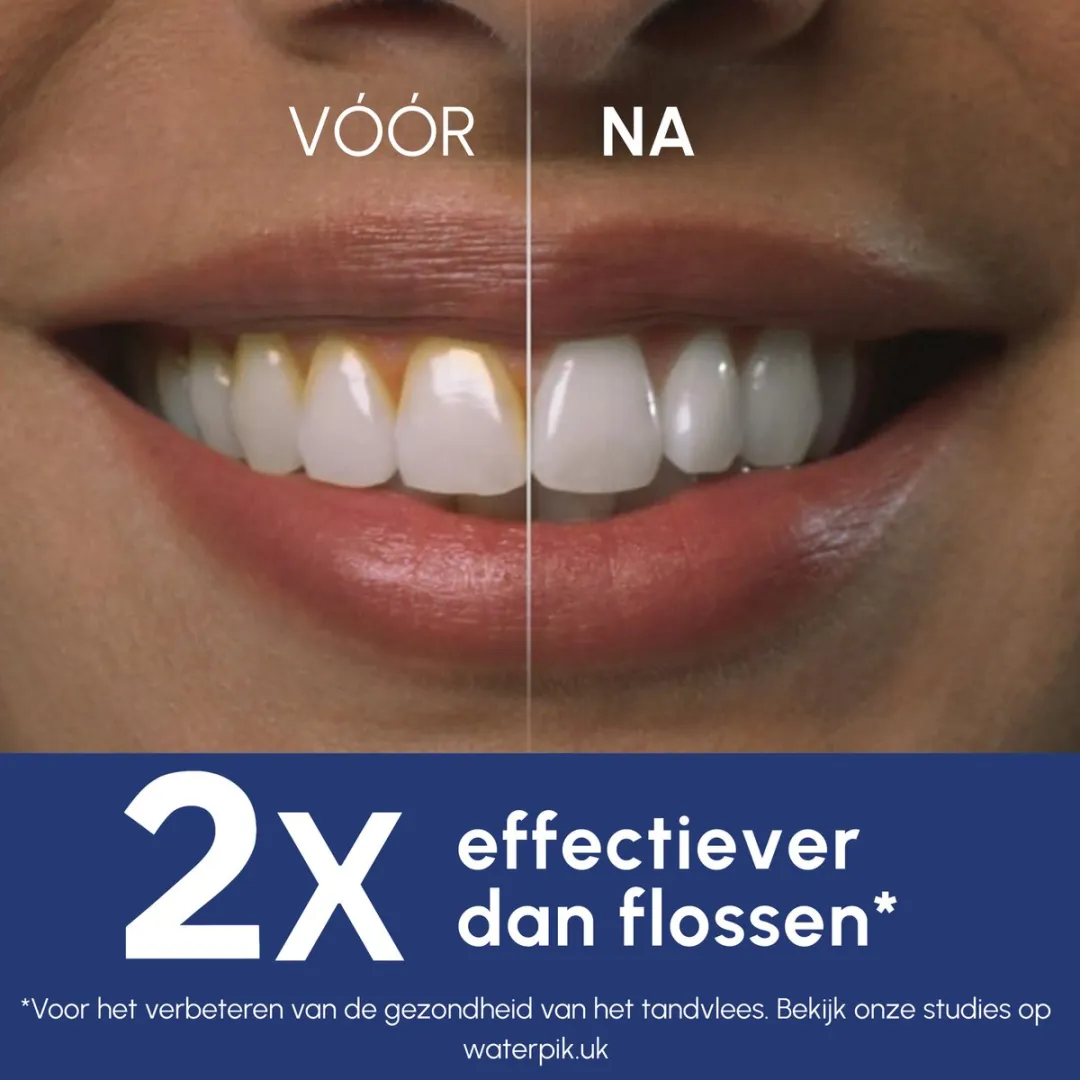 Waterpik Cordless Pearl Waterflosser - 2 Snelheden - Wit
