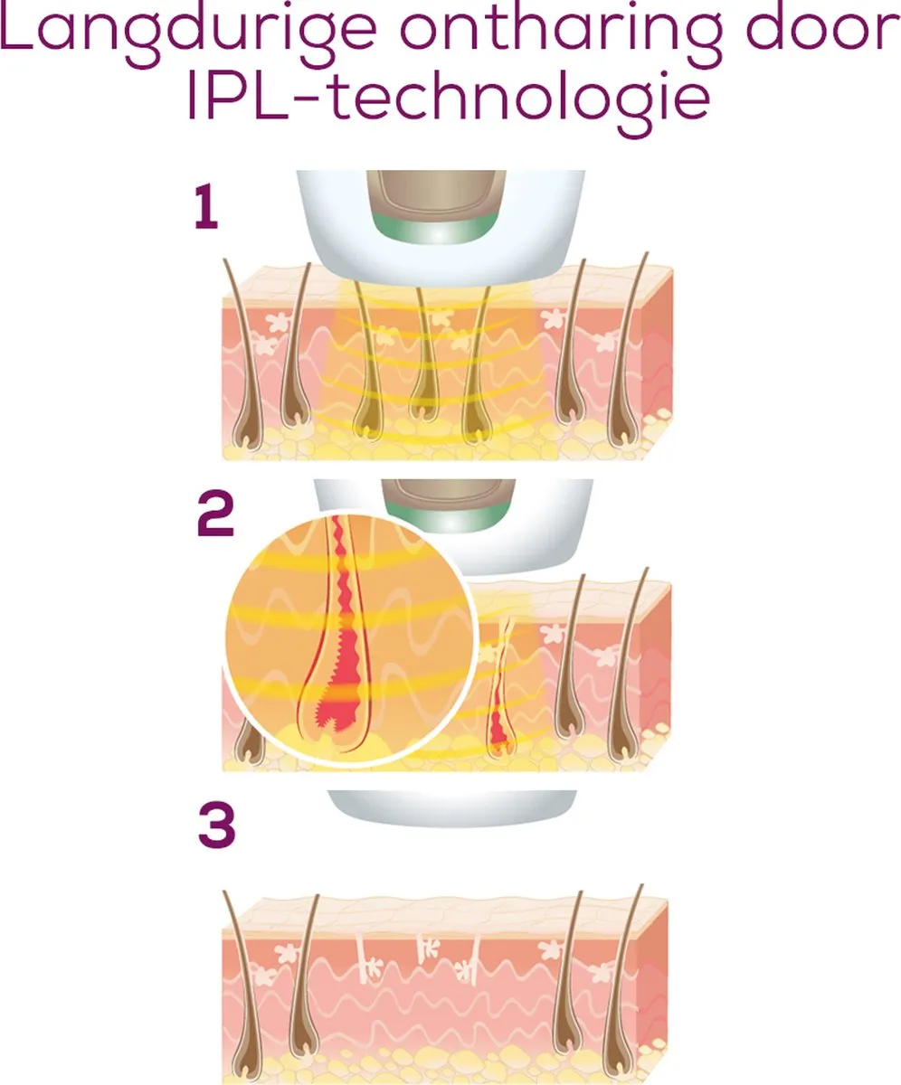 Beurer IPL Velvet Skin Pro 8800 Ontharingsapparaat - 600.000 Flitsen - Zwart/Brons