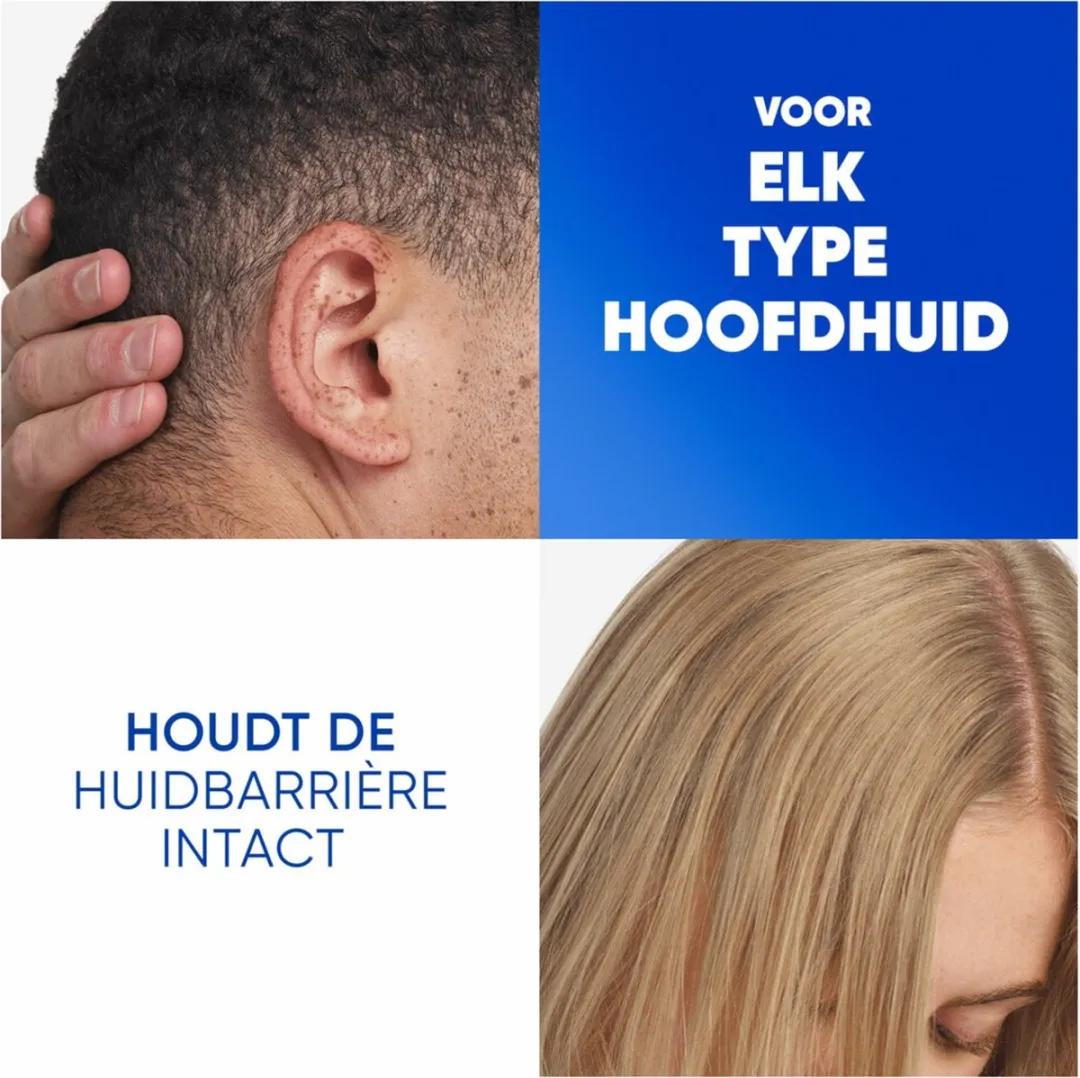 Head & Shoulders 2in1 Jeukende Hoofdhuid 300ml