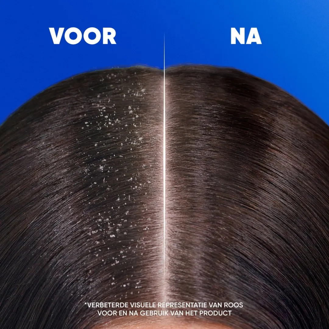 Head & Shoulders Apple Fresh Anti-Roos Shampoo 1000ml