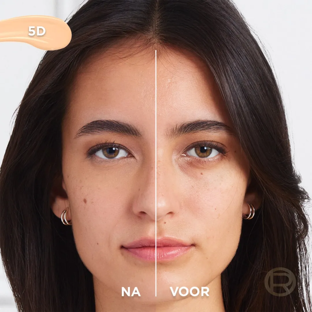 L'Oréal Paris True Match Radiant Serum Concealer 5D - 11ml