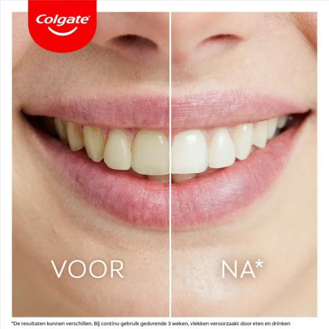 Colgate Max White Overnight Tanden Whitening Serum 2.5ml - 3 Stuks - afbeelding 6 van 6