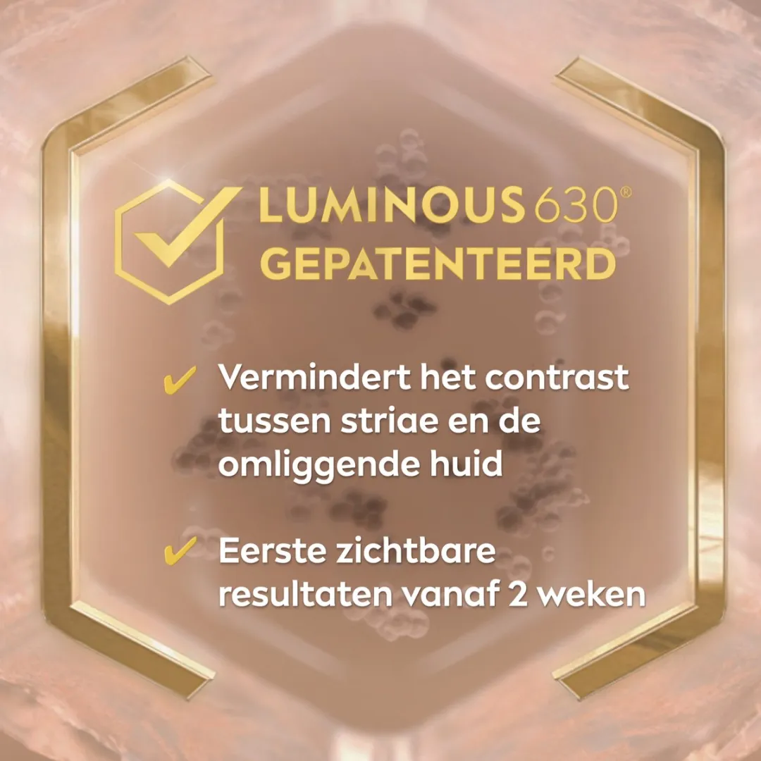NIVEA Luminous 630 Anti-Striae Crème 200ml