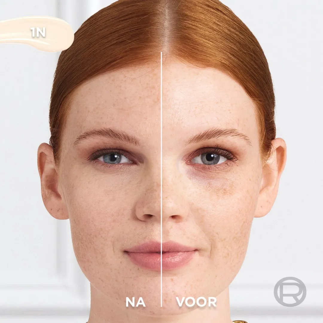 L'Oréal Paris True Match Radiant Serum Concealer 1N - 11ml
