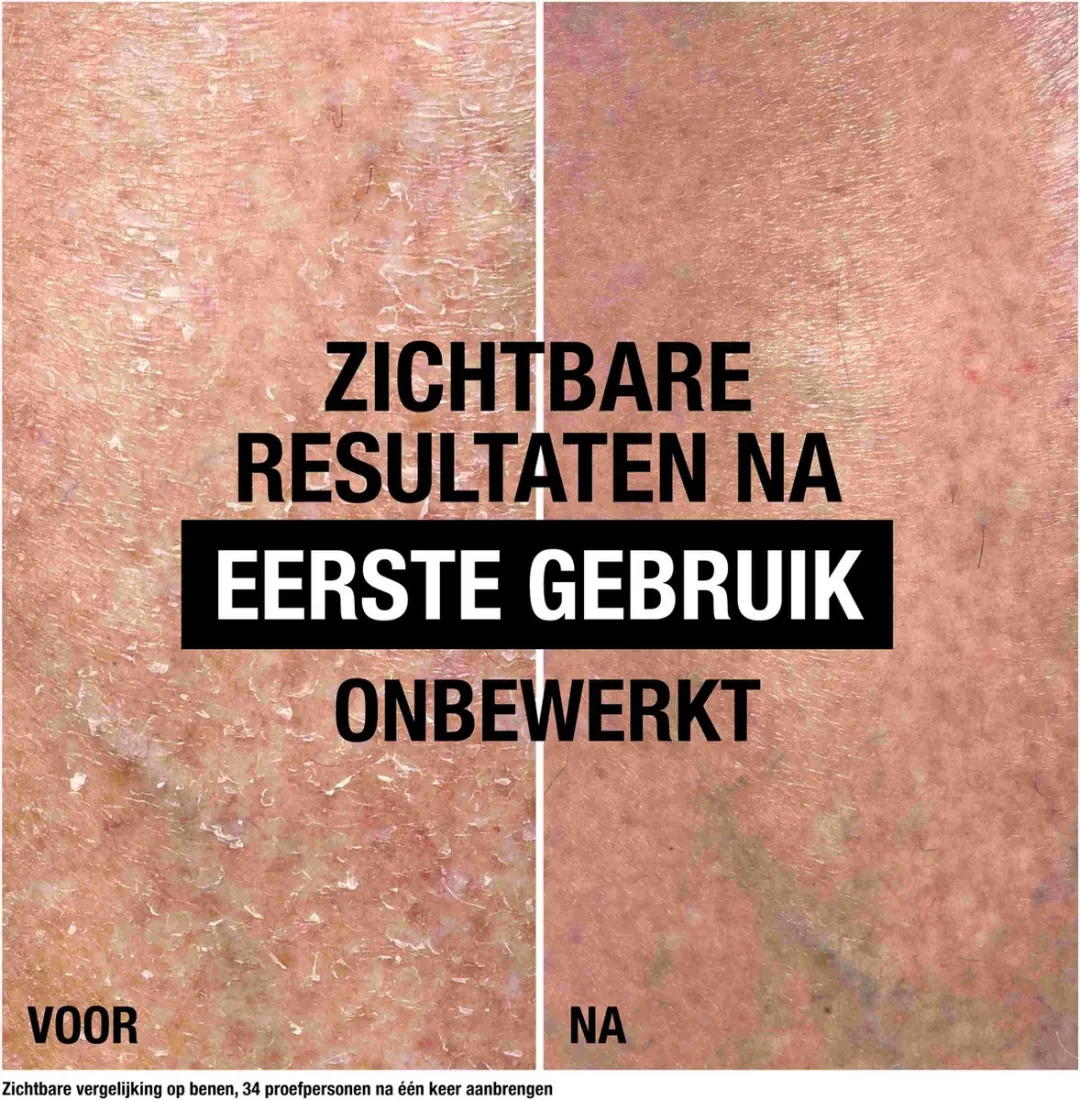 Neutrogena Intense Repair Cica Body Balsem - 2x250ml