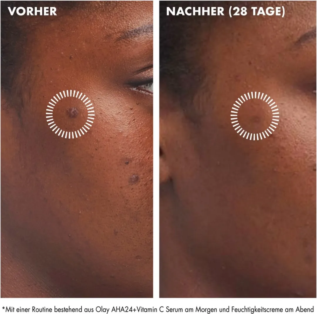 Olay Regenerist Dagcrème AHA 24 + Vitamine C 50ml - afbeelding 6 van 6