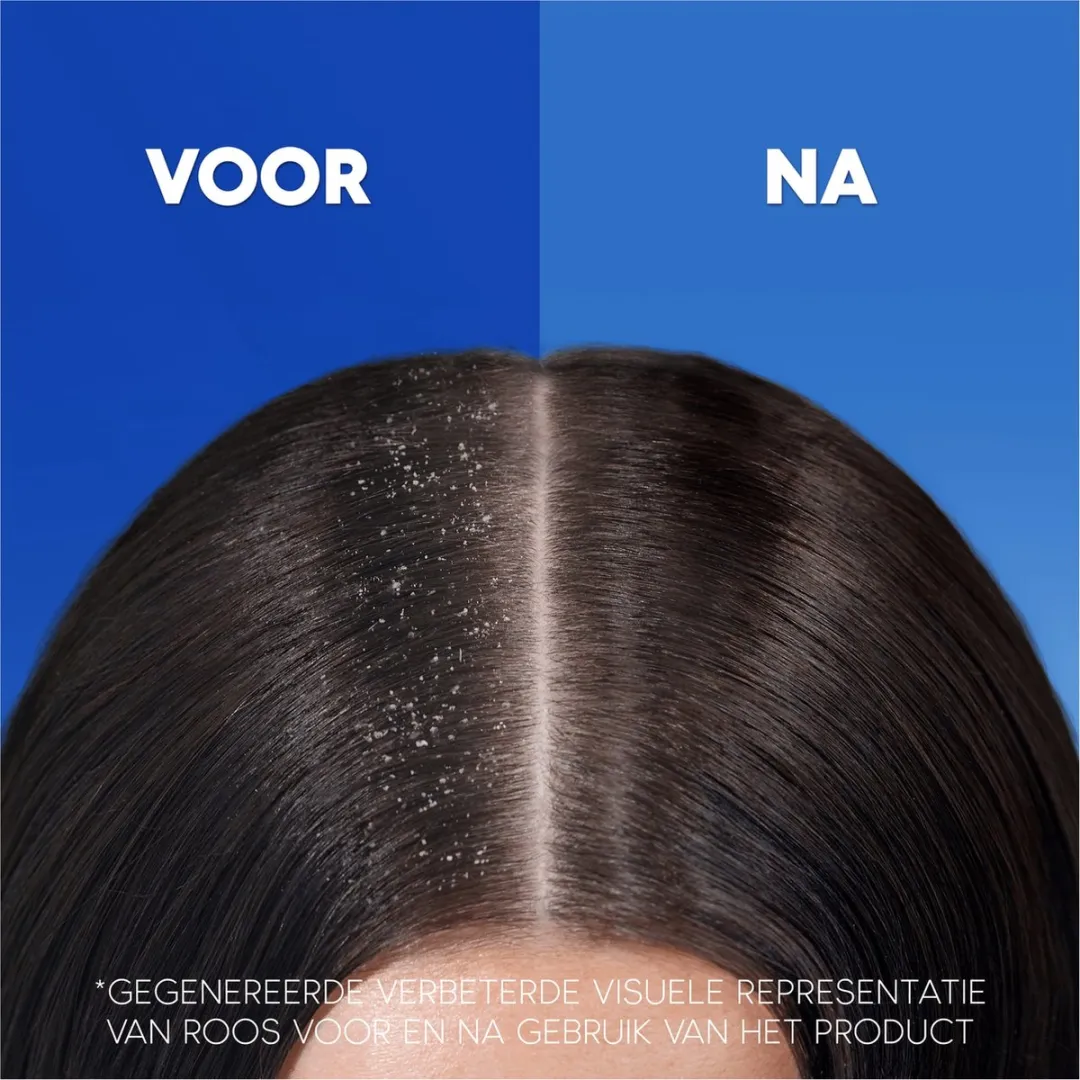 Head & Shoulders Citrus Fresh Anti-roos Shampoo 285ml - 6 Stuks