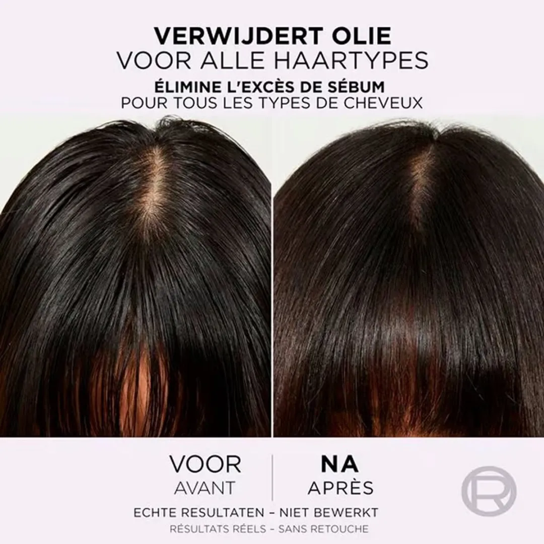 L'Oréal Paris Elseve Hyaluron Conditioner 250ml