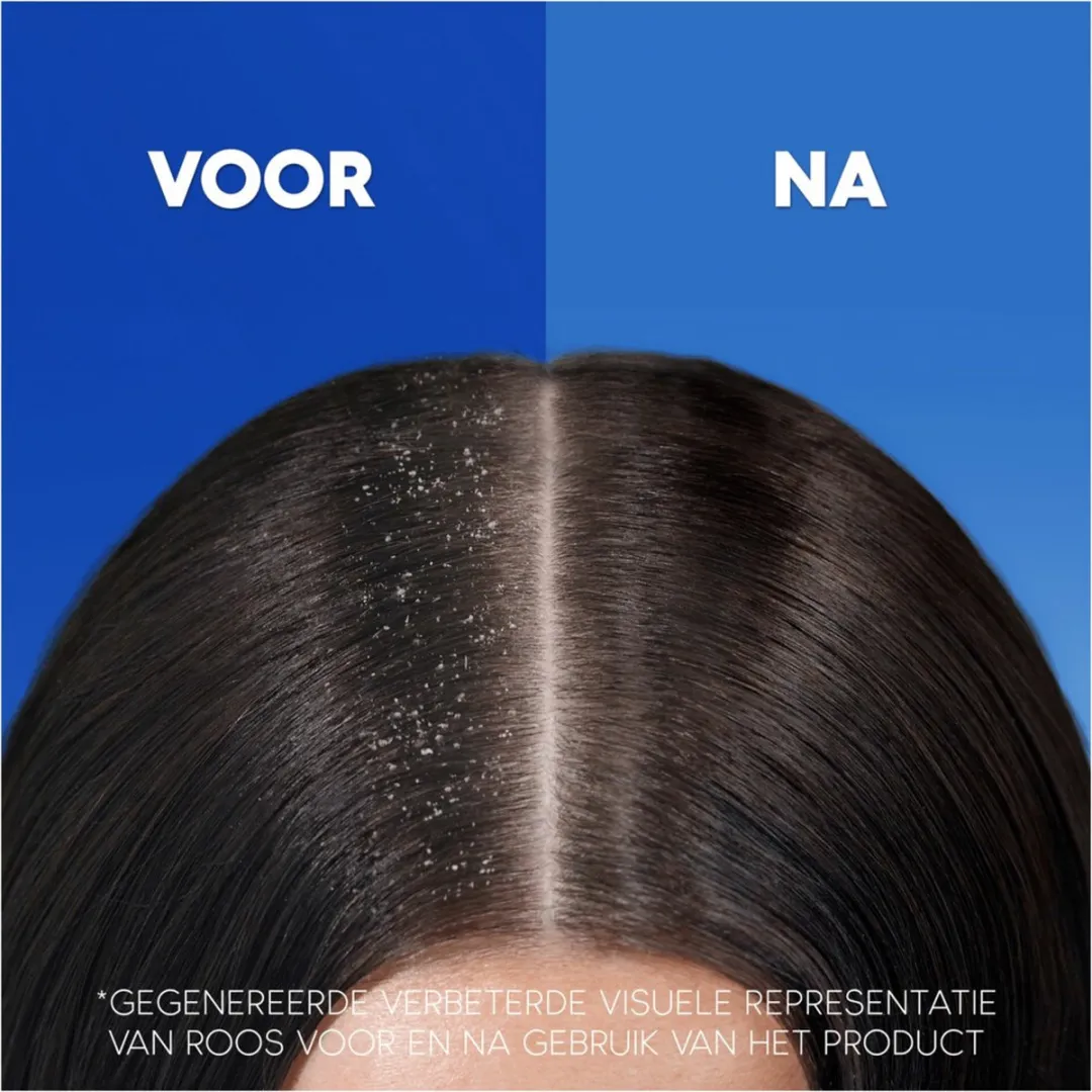 Head & Shoulders - Anti-Roos Shampoo - Anti-Haaruitval - Met Cafeïne - 285 ml