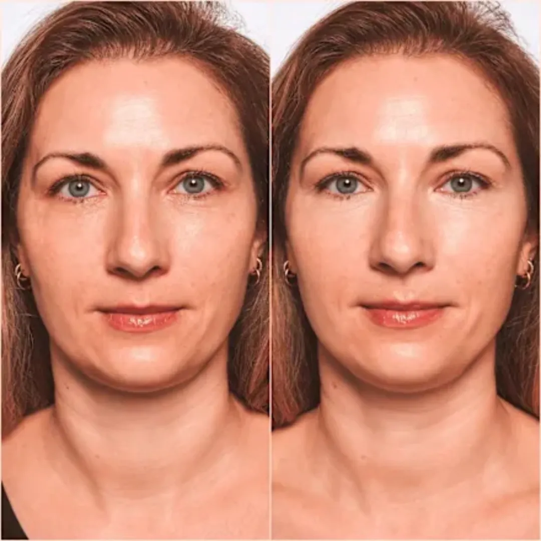 Catrice True Skin High Cover Concealer 005 Warm Macadamia - 4,5 ml