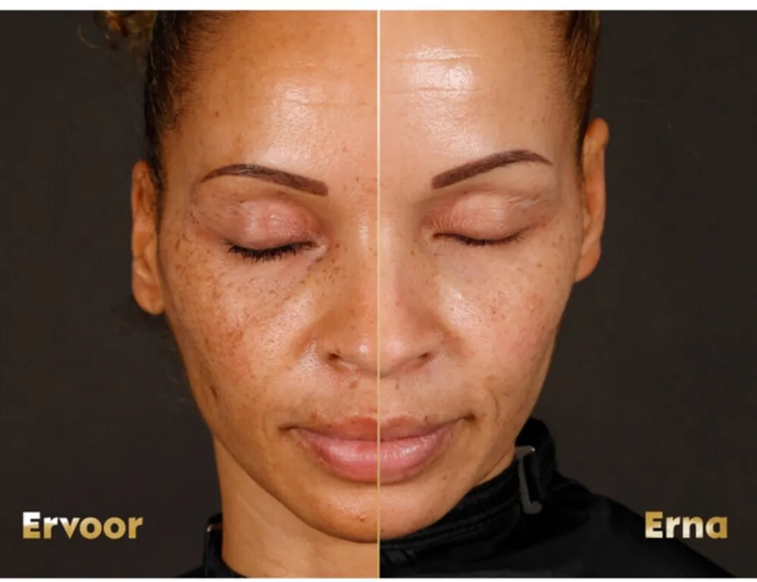 NIVEA Cellular LUMINOUS630 Dagcrème SPF 50 - 2 Stuks