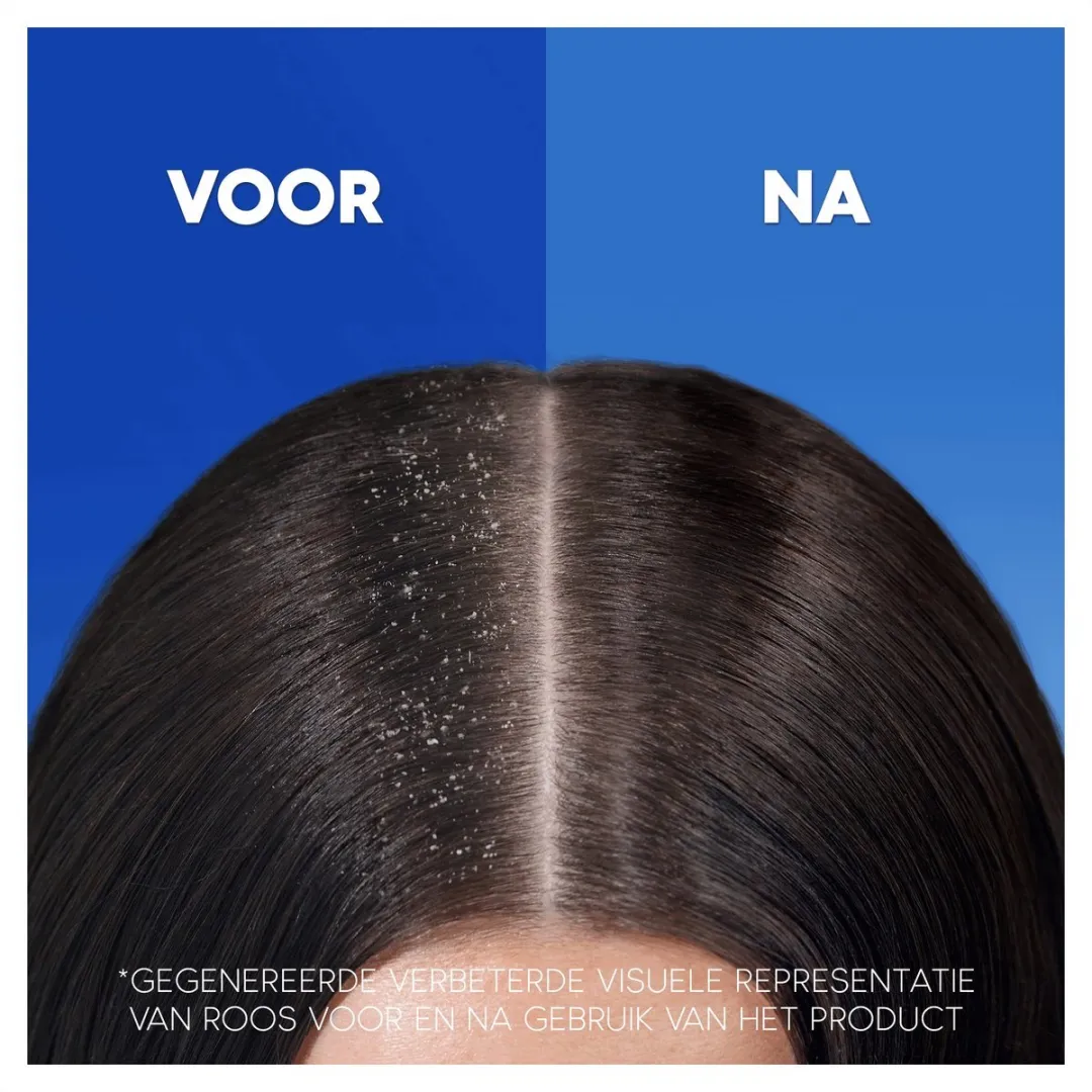Head & Shoulders Anti-Roos Shampoo Apple Fresh 1000ml