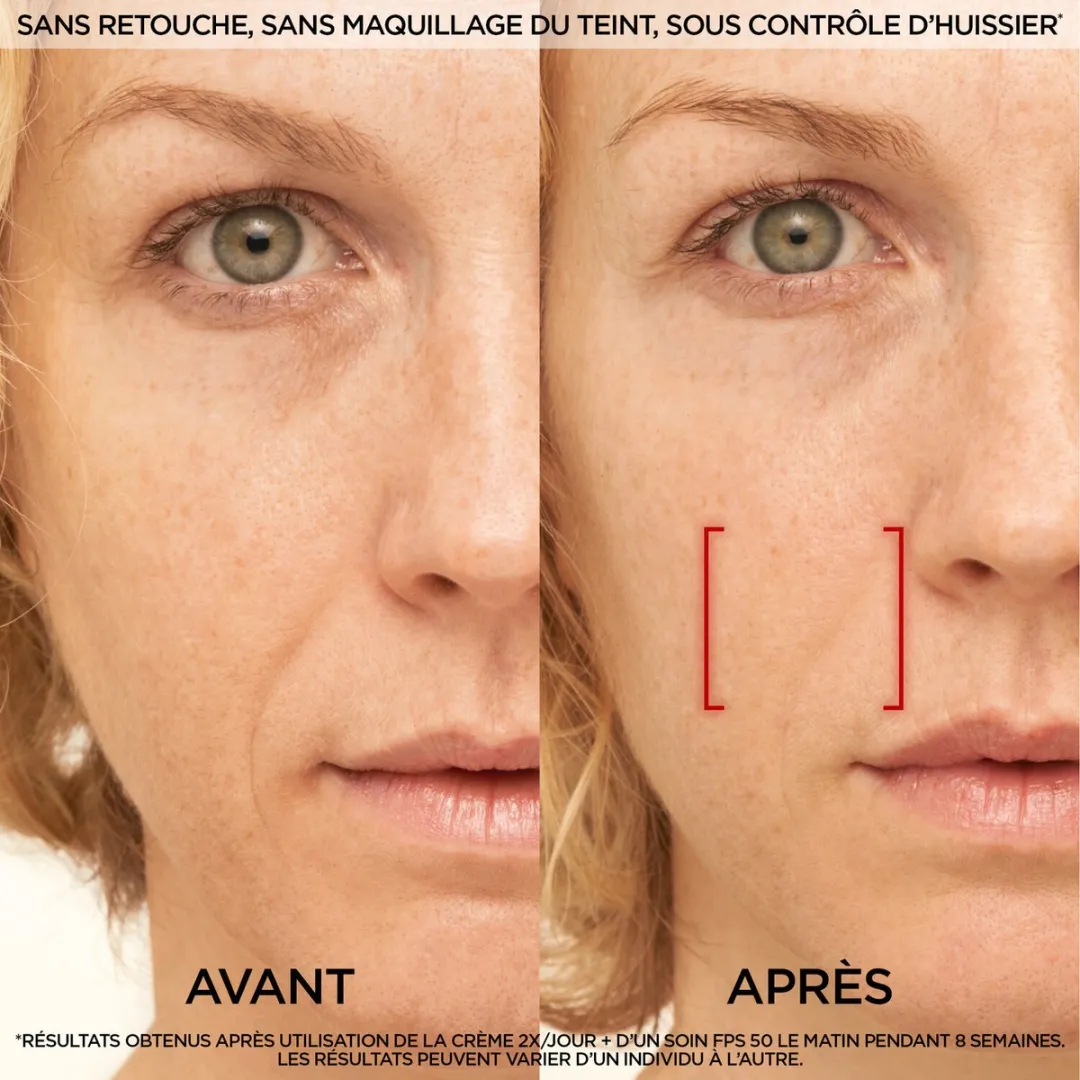 L'Oréal Paris Revitalift Laser Dagcrème 50ml