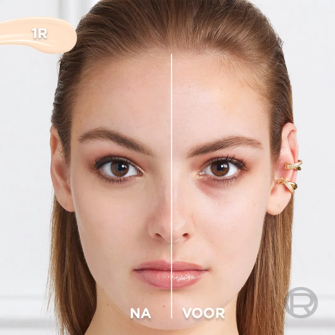 L'Oréal Paris True Match Radiant Serum Concealer 1R - 11ml