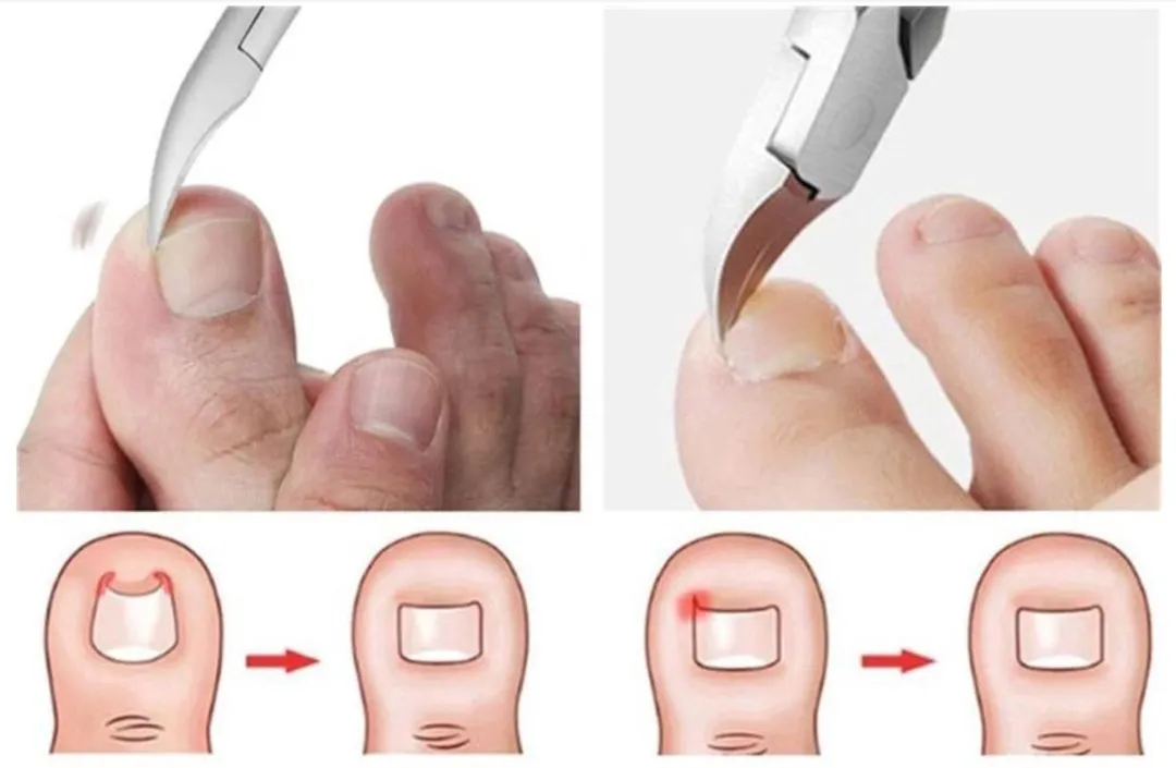 Wilkinson Sword Nageltang - 120g - MÉTAL