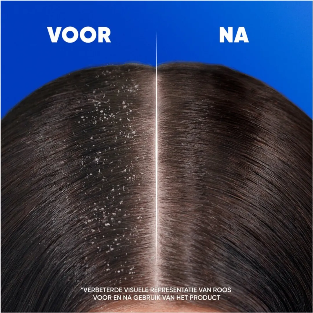 Head & Shoulders 2in1 Citrus Fresh Shampoo 300ml