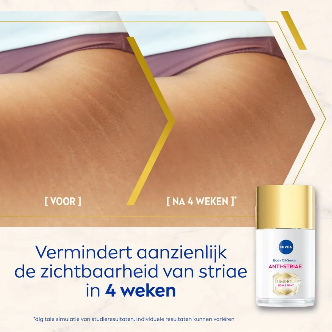 NIVEA Luminous630 Anti-Striae Lichaamsolie 100ml