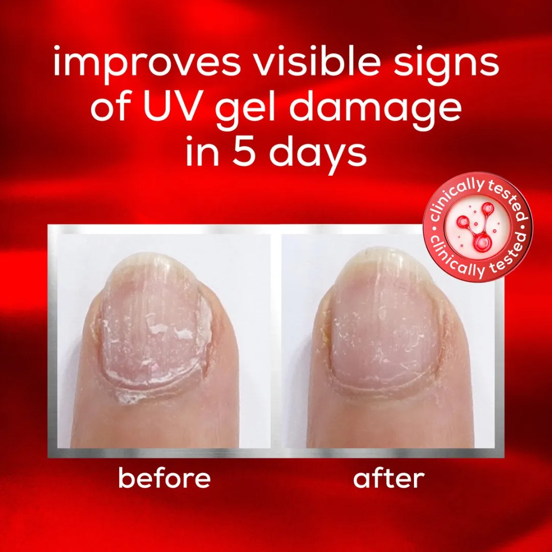 essie To the Rescue Nagelverzorging 13,5ml