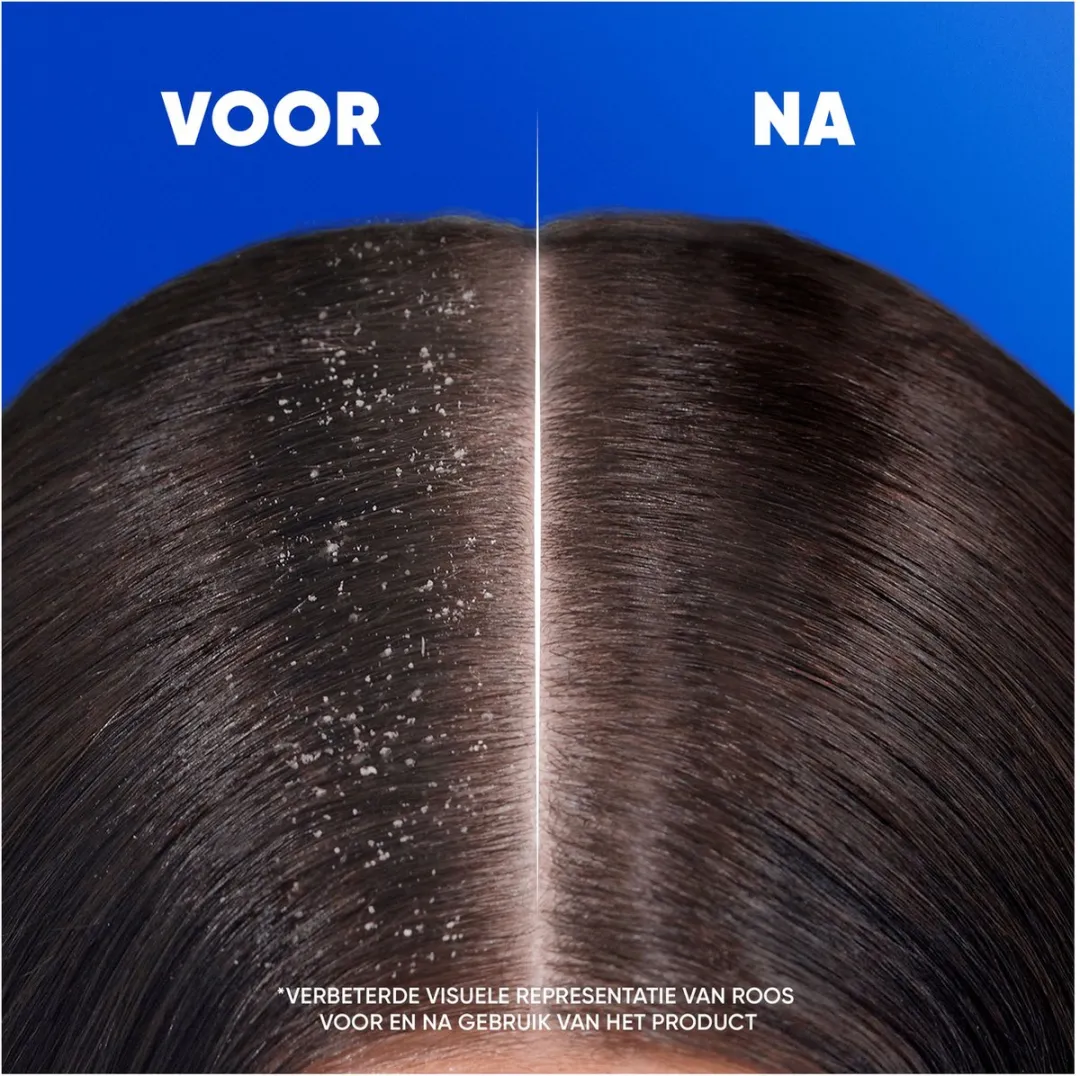 Head & Shoulders Menthol Fresh 2-in-1 Shampoo - 6x300ml