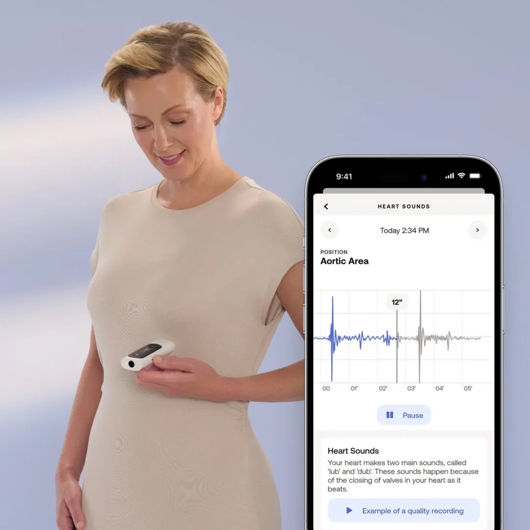 Withings BeamO MultiScan Health Monitor - 8 Personen - Wit/Zwart - afbeelding 6 van 6